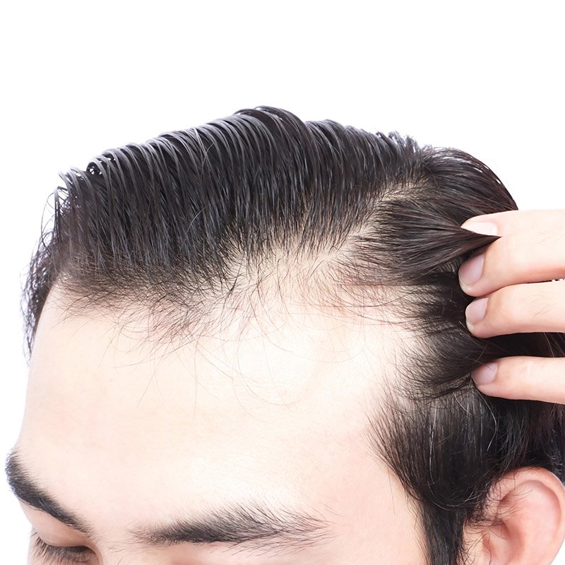 Hair Transplant Repair