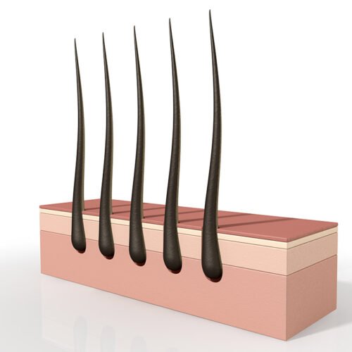 Surgical Hair Cloning